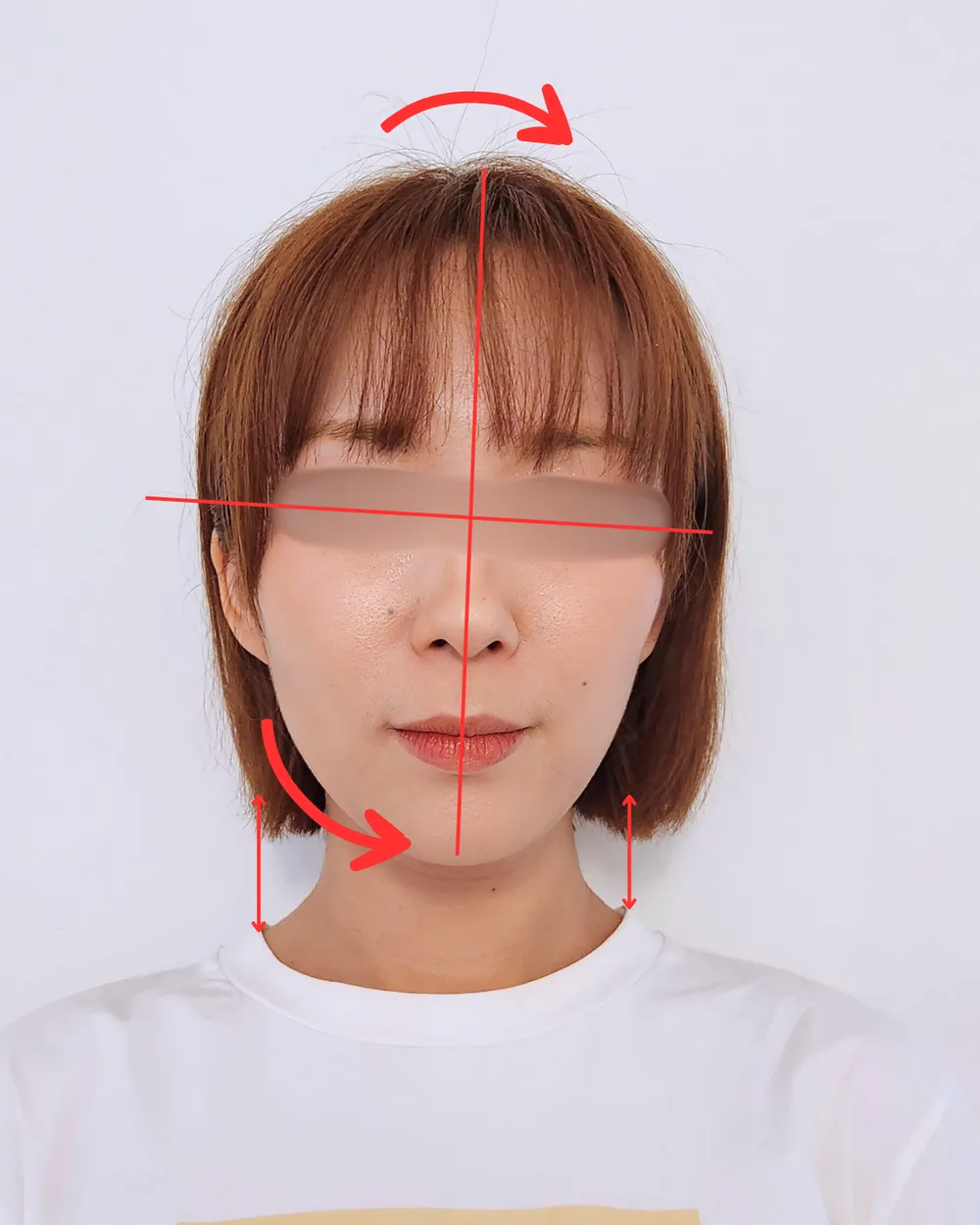 30代女性 顔の歪み、むくまない顔にしたい 解析