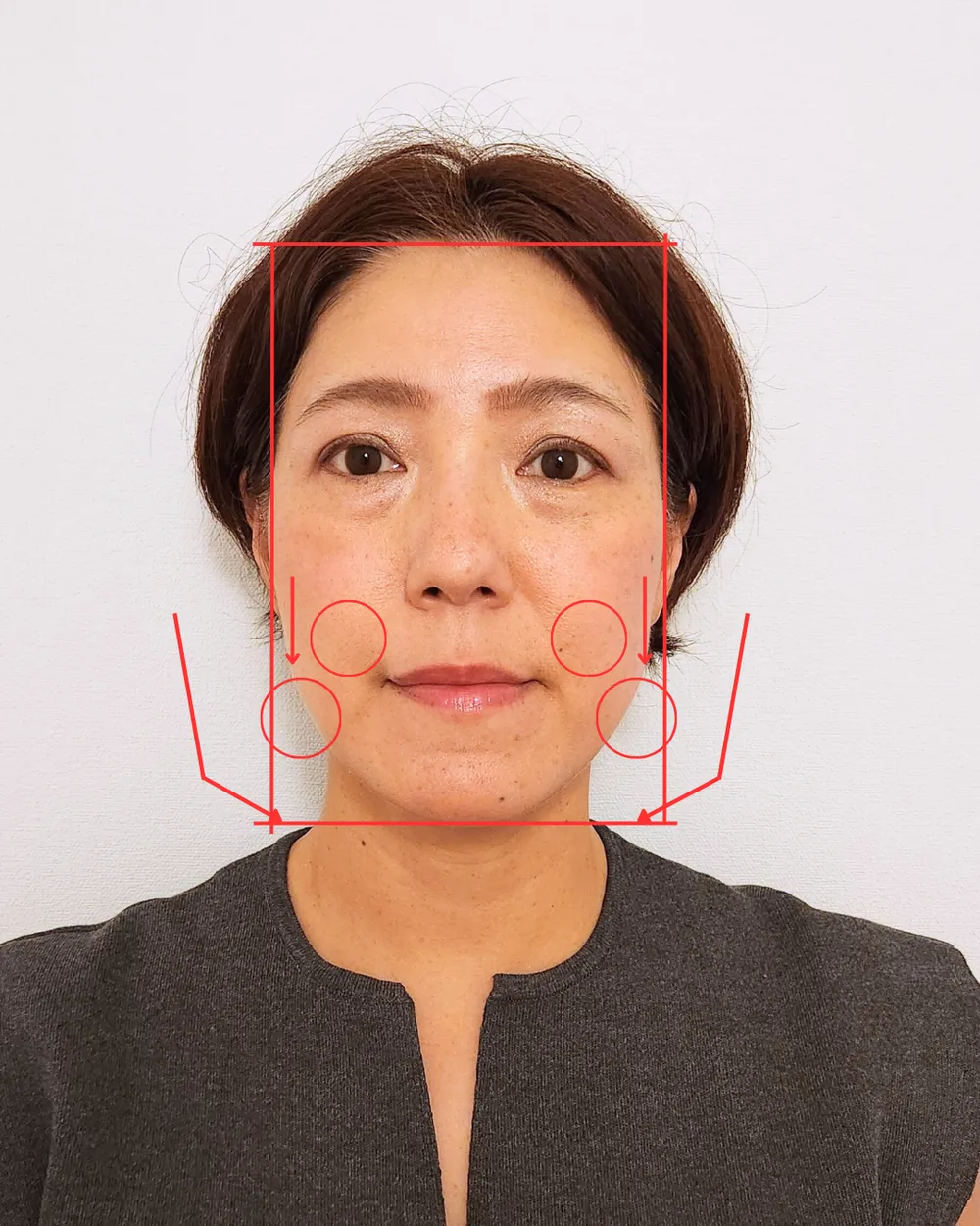 50代女性 たるみと顔が伸びた気がする 解析