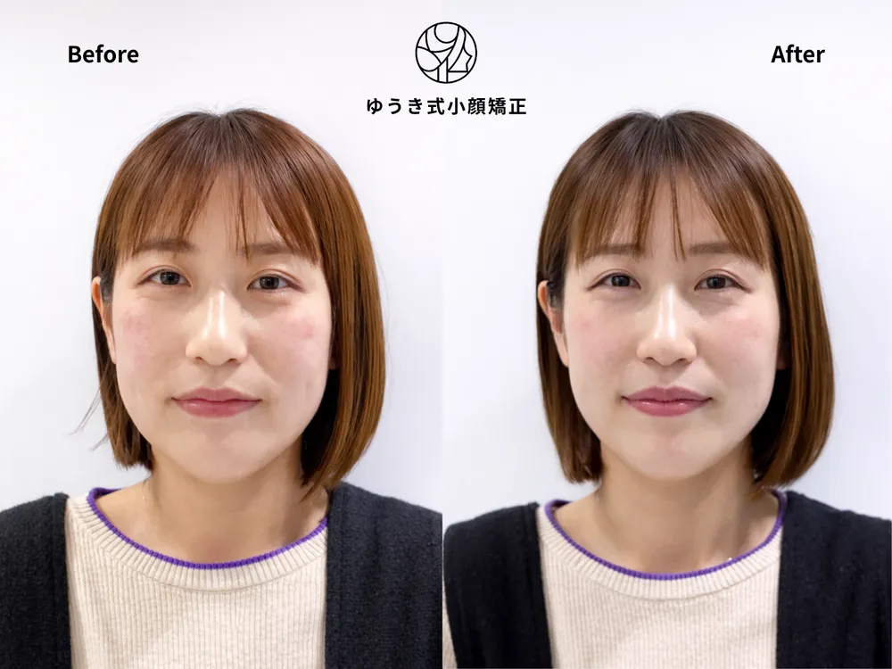 40代女性 年齢と共に顔が変化してきた Before/After
